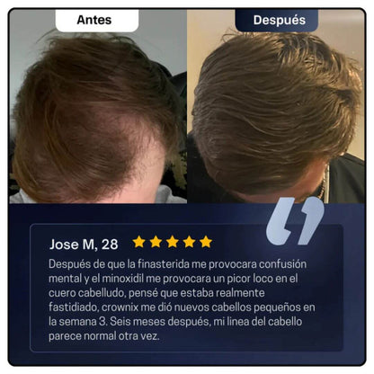 Serum Bodywise™ – Crecimiento Capilar Avanzado