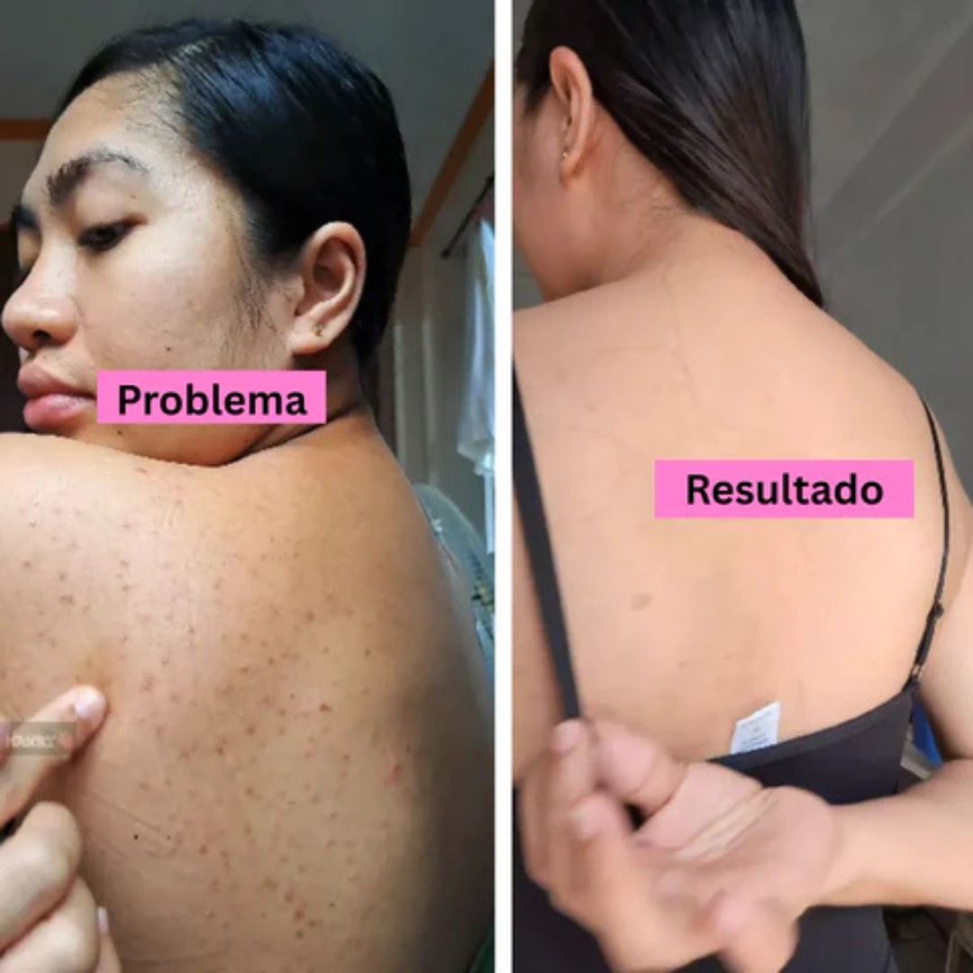 ConfidBack™ – Espalda limpia, confianza total