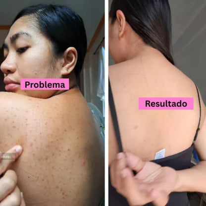 ConfidBack™ – Espalda limpia, confianza total