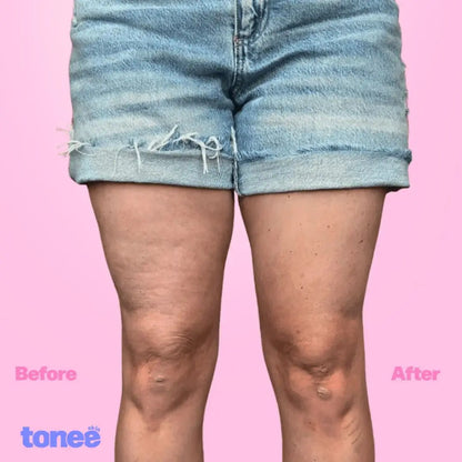 LiftSkin™ Elevación inmediata, sin fajas. x60 Unidades