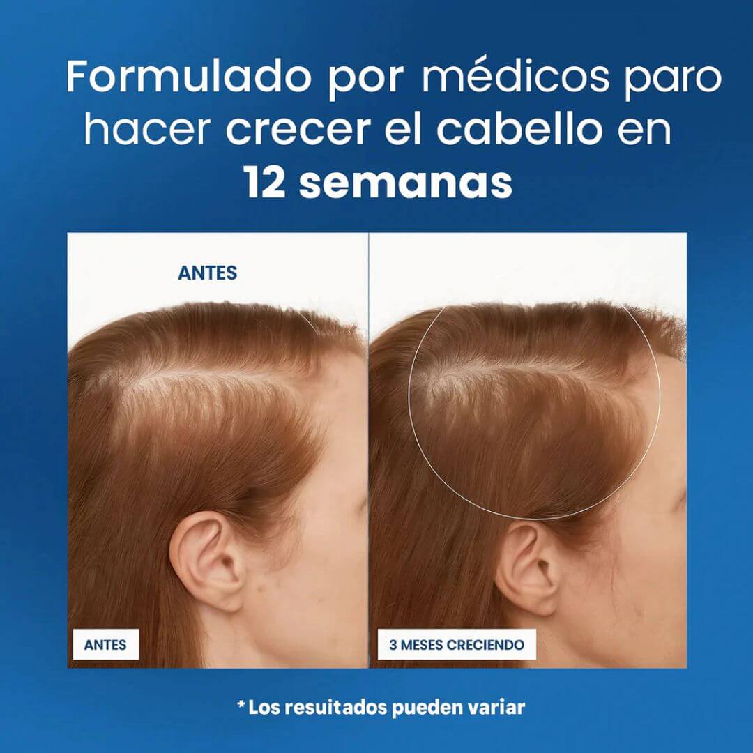 Serum Bodywise™ – Crecimiento Capilar Avanzado