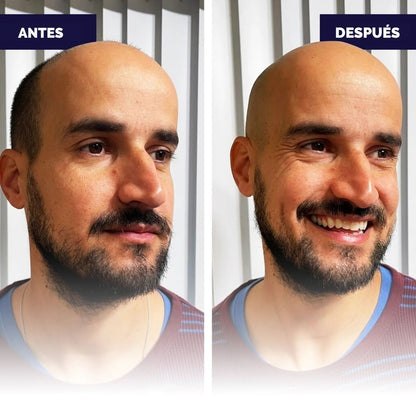 FlexSeries™ – Afeitado Perfecto Sin Irritación en Minutos