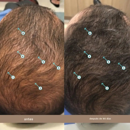 SPECTRAL PRO™ Apariencia de cabello más denso desde la raíz.