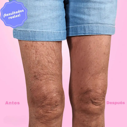 LiftSkin™ Elevación inmediata, sin fajas. x60 Unidades