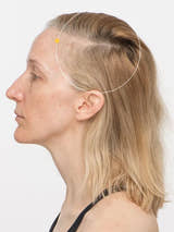 Tanya antes de tomar Nutrafol Women